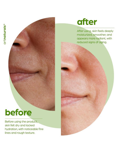 Aceite Facial de Squalano Artnaturals 28.35 ml Hidratante Vegano