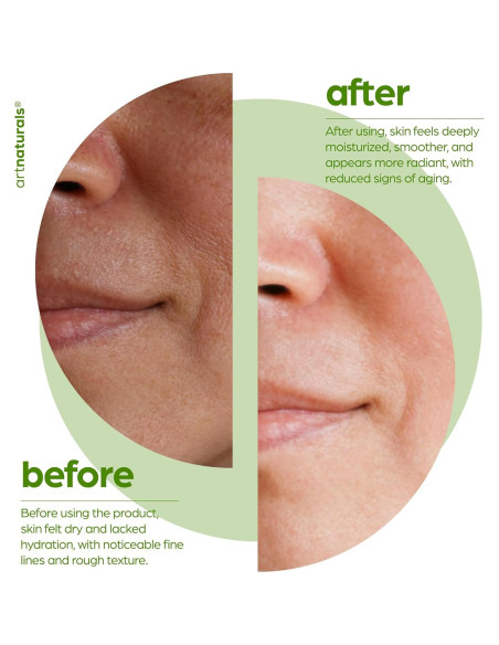 Aceite Facial de Squalano Artnaturals 28.35 ml Hidratante Vegano