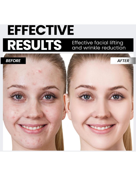 Dispositivo Facial de Microcorriente Hunvva EP-300 Luz Roja