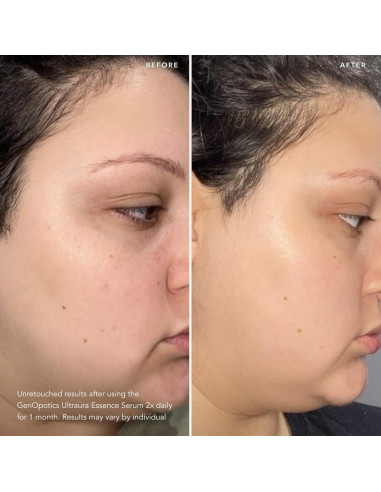 SK-II Dúo Radiancia y Firmeza - Suero GenOptics 50 ml + Hidratante SKINPOWER 80 ml