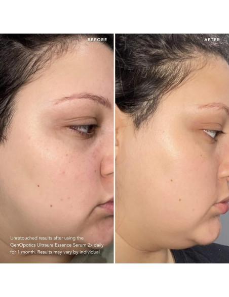 SK-II Dúo Radiancia y Firmeza - Suero GenOptics 50 ml + Hidratante SKINPOWER 80 ml