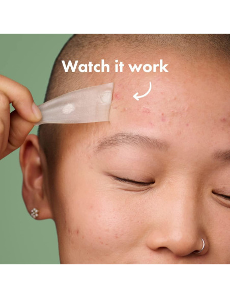 Mighty Patch Surface Hero Cosmetics - Parche acné XL 10 unidades