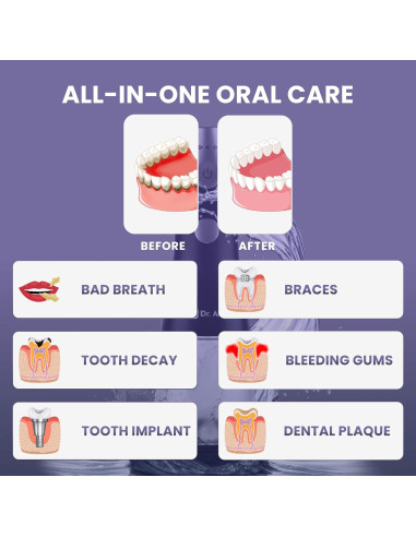 Irrigador Dental Dr. Aid Portátil Inalámbrico Negro 326ml