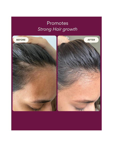 Aceite Natural para el Crecimiento del Cabello Rest 100 ml