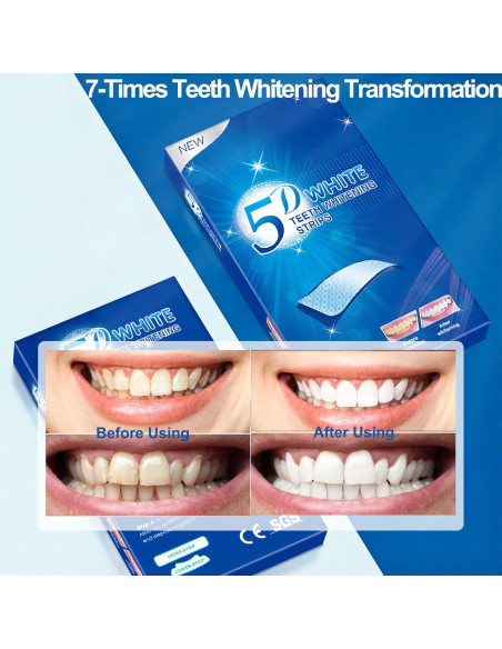 Kit de Tiras Blanqueadoras de Dientes Keepzi - 28 Piezas, Sin Sensibilidad