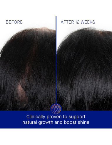 Tratamiento del cuero cabelludo Augustinus Bader 30ml Azul