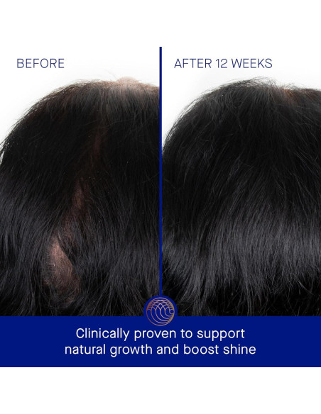 Tratamiento del cuero cabelludo Augustinus Bader 30ml Azul Tratamiento del cuero cabelludo Augustinus Bader 30ml Azul