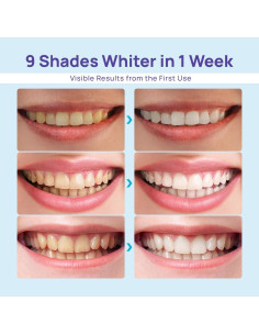 Kit Blanqueamiento Dental Whitebite Pro - Luz LED + Gel 35% 2