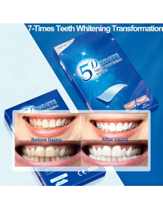 Kit de Tiras Blanqueadoras de Dientes Keepzi - 28 Piezas, Sin Sensibilidad 2