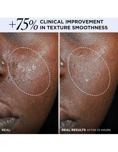 Hidratante Facial Diario IT Cosmetics 56.7g - Barrera de Piel