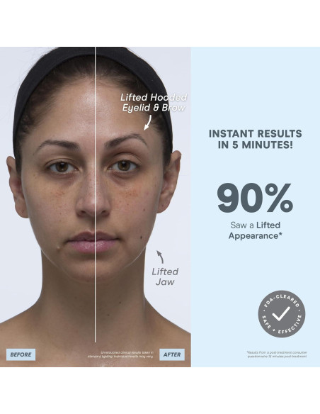 Dispositivo Facial Microcorriente NuFACE MINI+ - Tonifica y Levanta Dispositivo Facial Microcorriente NuFACE MINI+ - Tonifica y Levanta