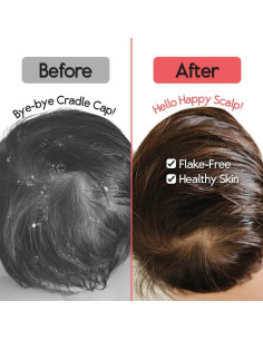 Cepillo para Costra Láctea SplashEZ - Silicona Suave 2 Piezas 2