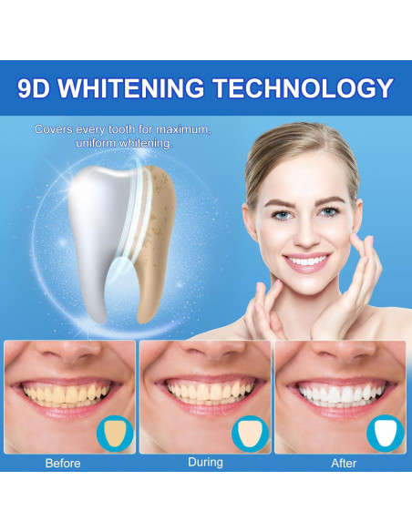 Kit de Tiras Blanqueadoras Ruduwu para Dientes Sensibles - 28 Tiras