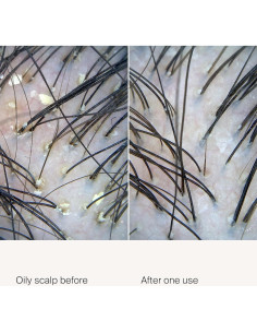 Exfoliante para Cuero Cabelludo Living Proof 100 ml 2