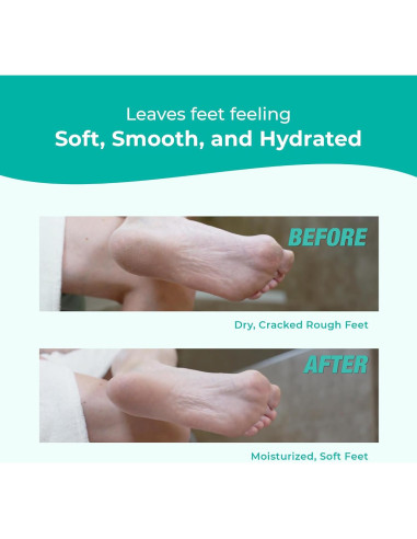 Crema para Pies Richenna EZ - Exfoliante y Hidratante 100ml