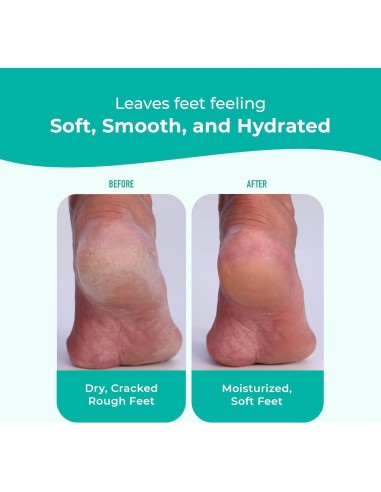 Crema para Pies Richenna EZ - Exfoliante y Hidratante 100ml