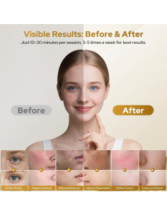 Máscara de Terapia de Luz Roja COSYBEE 280 LED 8 Modos Antienvejecimiento 2