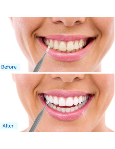 100 Piezas Cepillos Interdentales Patelai Higiene Oral Gris