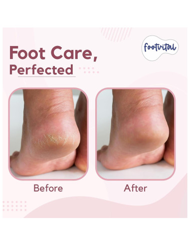 Lima de pies Footvital FV-Foot-File - Acero inoxidable ergonómico