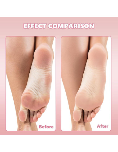 Repuestos de Lima de Pedicura Flutesan 80 Pcs Acero Inoxidable