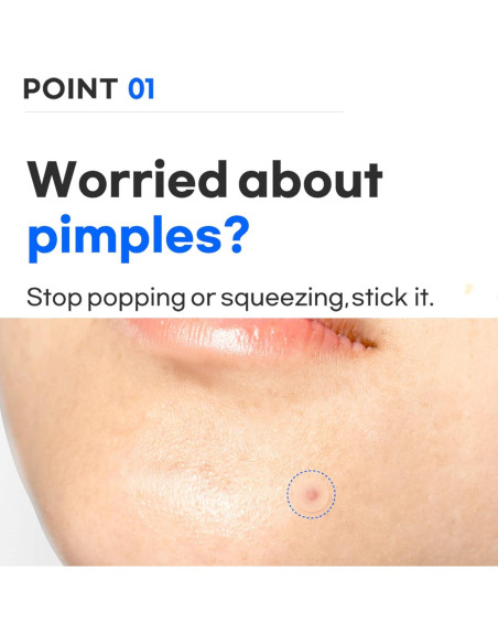 Parche Hidrocoloide TIA'M para Acné - 24 Unidades