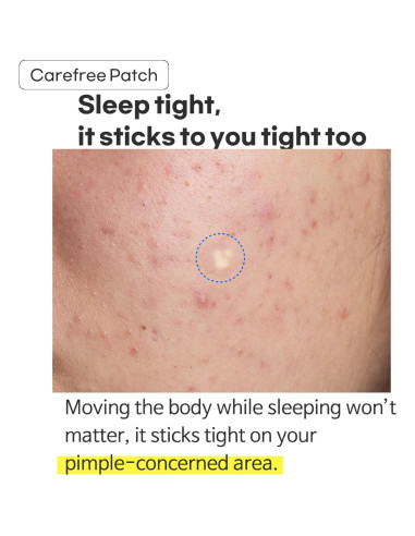 Parche Hidrocoloide TIA'M para Acné - 24 Unidades