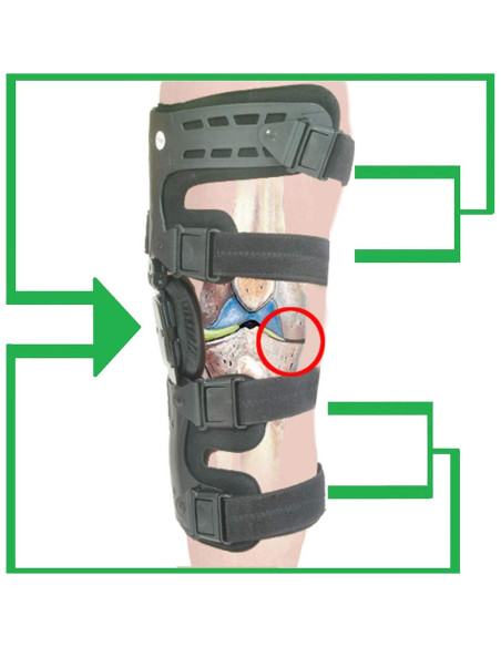 Férula Descompresora de Rodilla Orthomen Izquierda para Osteoartritis