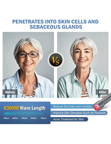 Dispositivo de Terapia de Luz Roja XyVoltic 5 en 1 Portátil