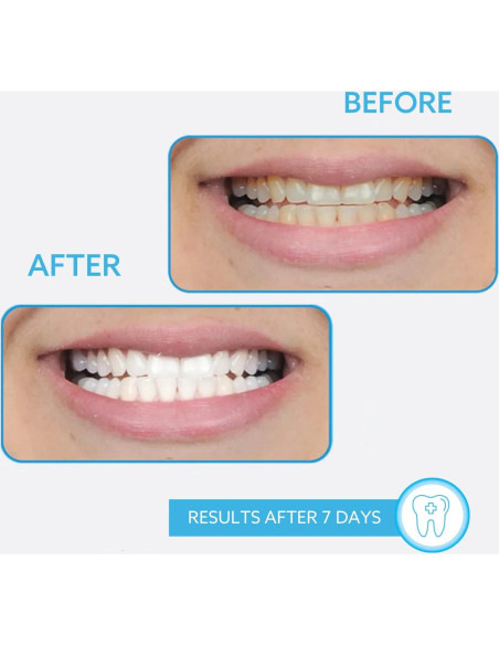 Bolígrafo Blanqueador GO SMILE 1.3mL para Dientes Blancos