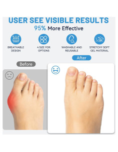 Manga para juanete LEOWEER con gel y ajuste antideslizante 2