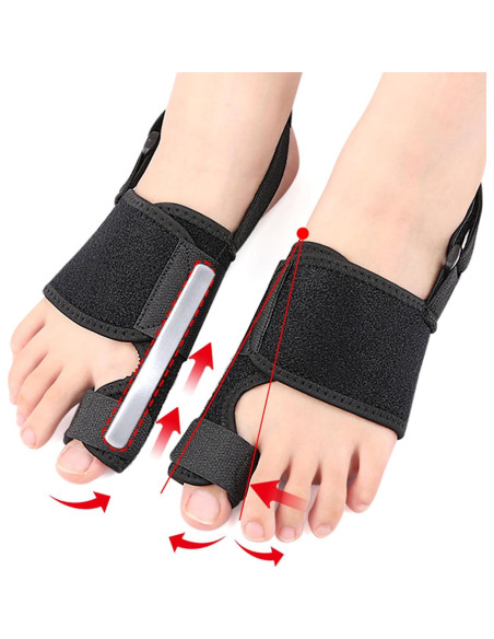 2 Correctores de Juanetes Lonicerkz para Alivio de Hallux Valgus