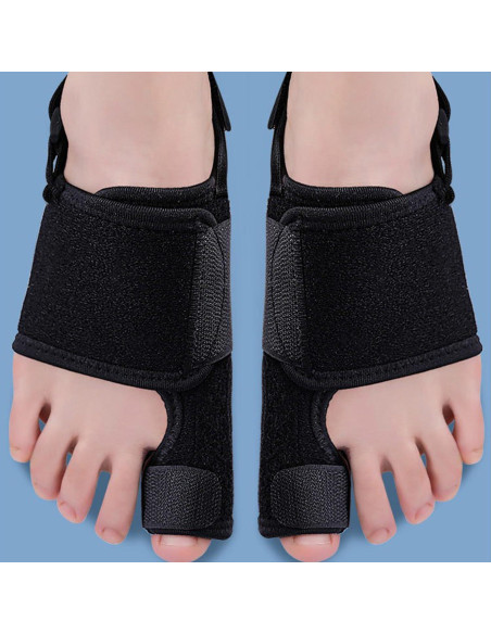 2 Correctores de Juanetes Lonicerkz para Alivio de Hallux Valgus