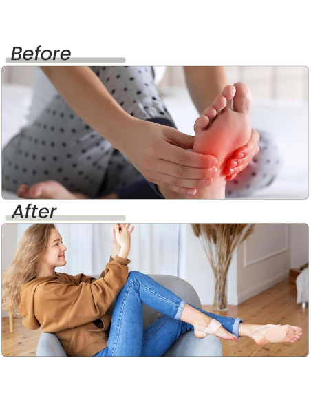 Soportes de Arco Bukihome Ajustables para Fascitis Plantar - Beige