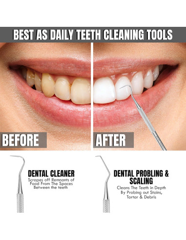 Escalador Dental Profesional Boujee Trends Doble Cara Acero Inoxidable