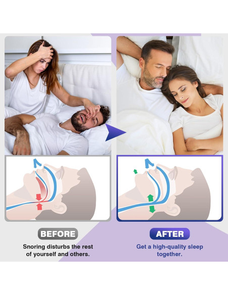 Clip Nasal Anti Ronquidos OHALEEP Silicona Ajustable Blanco M