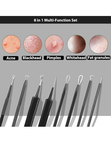 Kit de Extracción de Comedones Glamne - 8 Herramientas de Acero Inoxidable