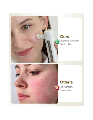 Máquina de Microdermoabrasión 4-en-1 kingdo - Exfoliador, Aspiradora de Poros, Nebulizador y Espejo LED