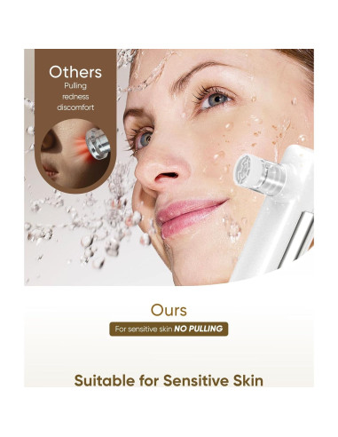 Máquina de Microdermoabrasión 4-en-1 kingdo - Exfoliador, Aspiradora de Poros, Nebulizador y Espejo LED