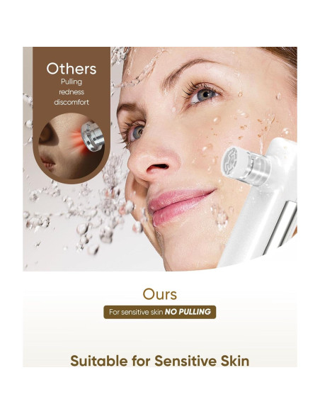 Máquina de Microdermoabrasión 4-en-1 kingdo - Exfoliador, Aspiradora de Poros, Nebulizador y Espejo LED