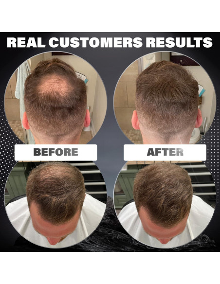 Fibras para Cabello Fino Castaño Rejuvenate Hair 27.5g