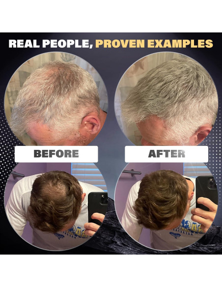 Fibras para Cabello Fino Castaño Rejuvenate Hair 27.5g