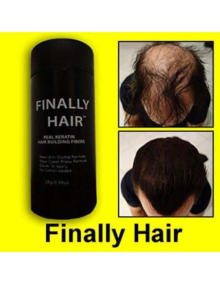 Concealer para Pérdida de Cabello Finally Hair Castaño 28g
