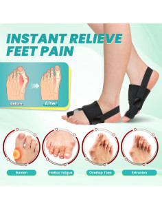 Corrector de Juanetes CEYOME - Férula Ajustable y Almohadillas de Silicona 2