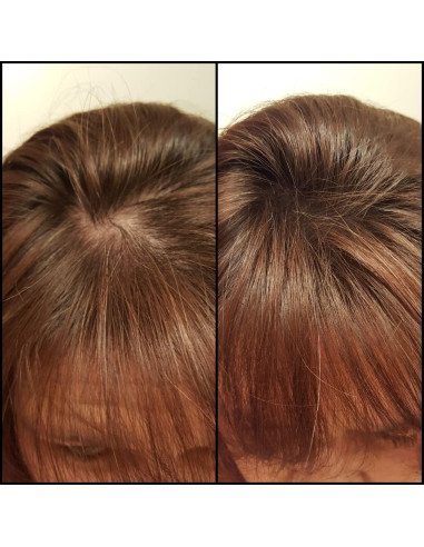 Fibra de Cabello Natural Caboki 3x30g Castaño - Suministro 270 Días