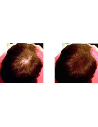 Fibra de Cabello Natural Caboki 3x30g Castaño - Suministro 270 Días