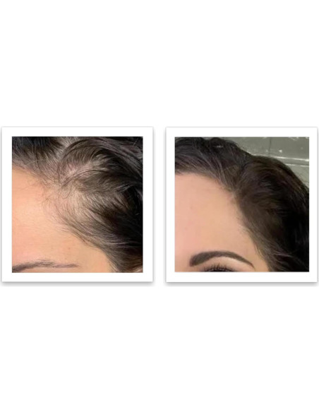 Caboki 10X Polvo para Cabello Ralo Castaño 45g - Libre de Talco