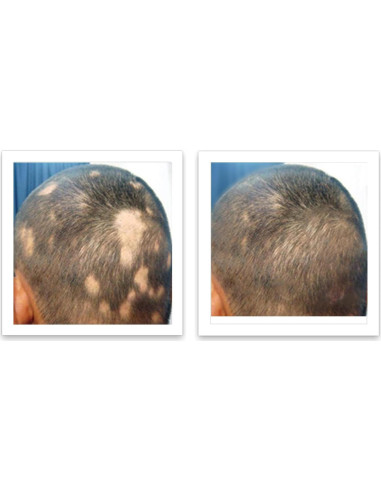 Caboki 10X Polvo para Cabello Ralo Castaño 45g - Libre de Talco