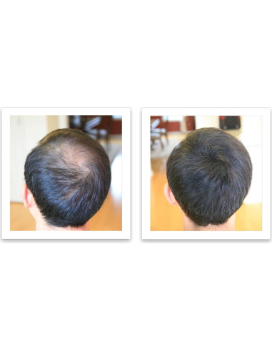 Caboki 10X Polvo para Cabello Ralo Castaño 45g - Libre de Talco