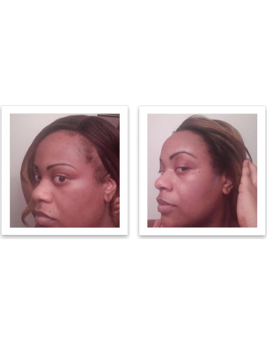 Caboki 10X Polvo para Cabello Ralo Castaño 45g - Libre de Talco