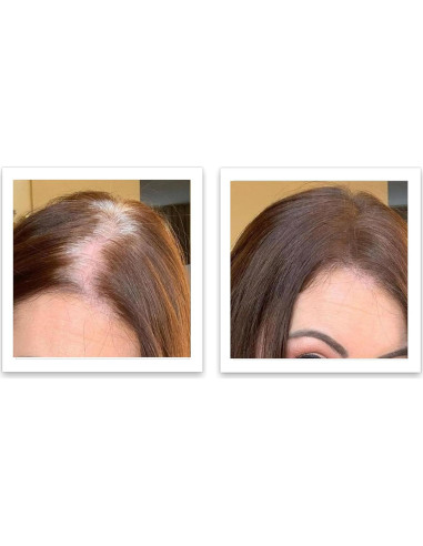 Caboki 10X Polvo para Cabello Ralo Castaño 45g - Libre de Talco